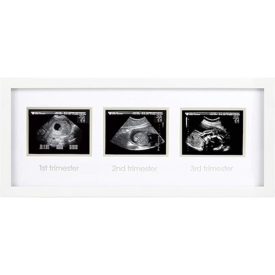 Cadre en bois pour maman enceinte pour femmes enceintes Cadre photo  sonogramme Cadre photo échographie pour bébé Idées cadeaux